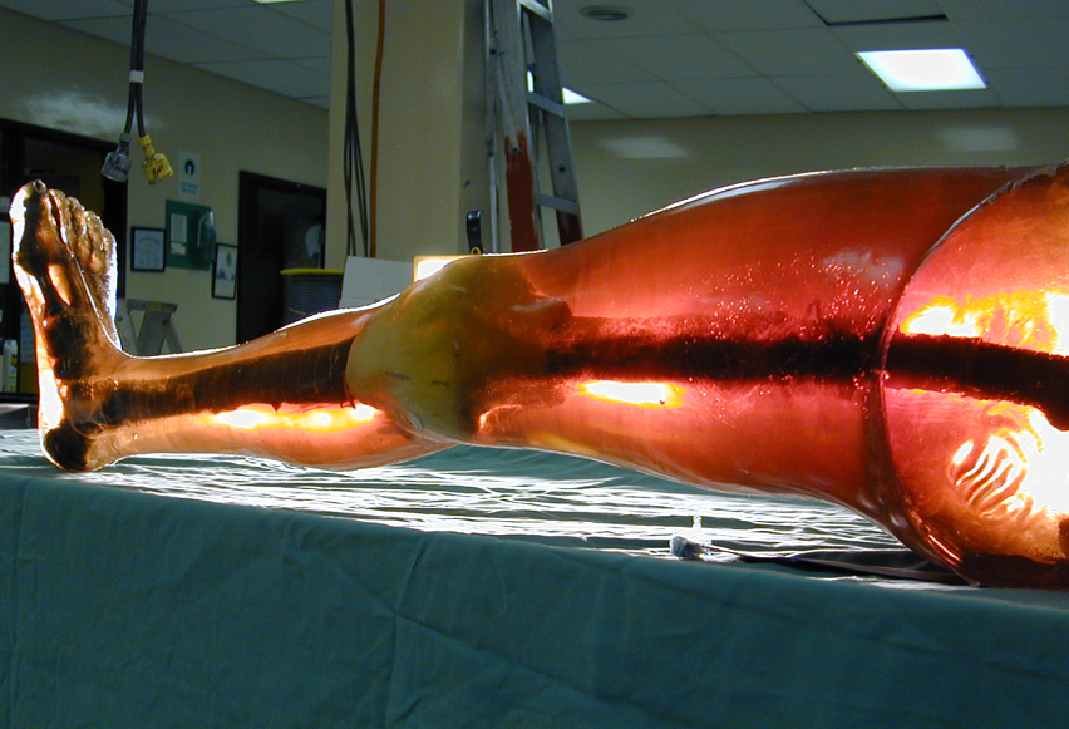 Frangible synthetic leg.