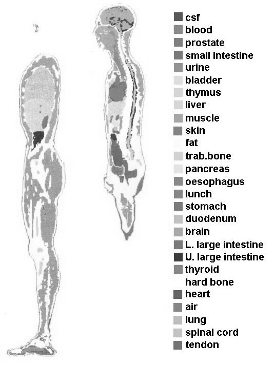 Sagittal slices of NORMAN (derived from [4]).